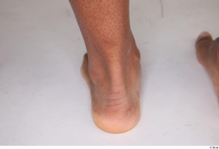 Catalina foot 0002.jpg